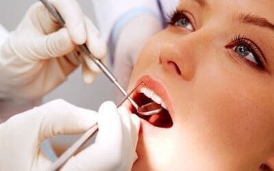 Types of Dental Crowns: Find the Best Option for Your Needs